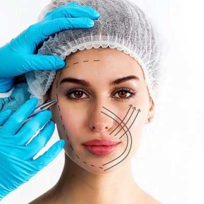 facelift-cosmetic treatments facelift profile image