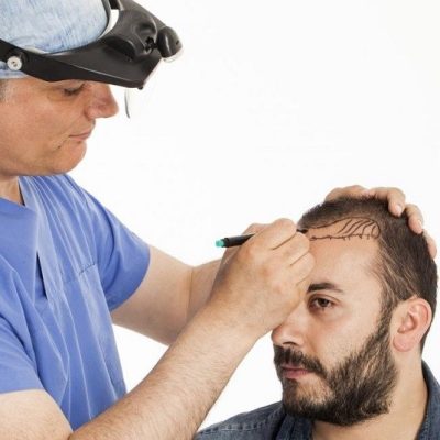 hair transplant-iran medical tours-letsseepersia hair transplant in iran