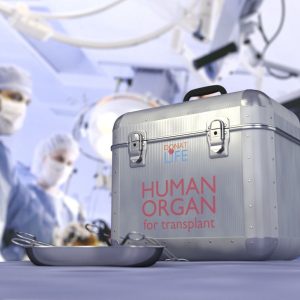 organ transplant surgery in iran organ transplant surgery profile